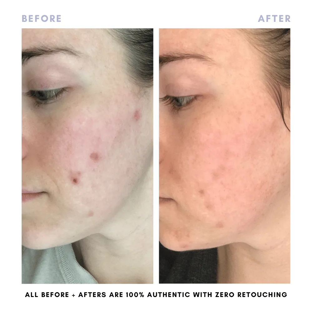 BUNDLE & SAVE! The Core Skincare Set