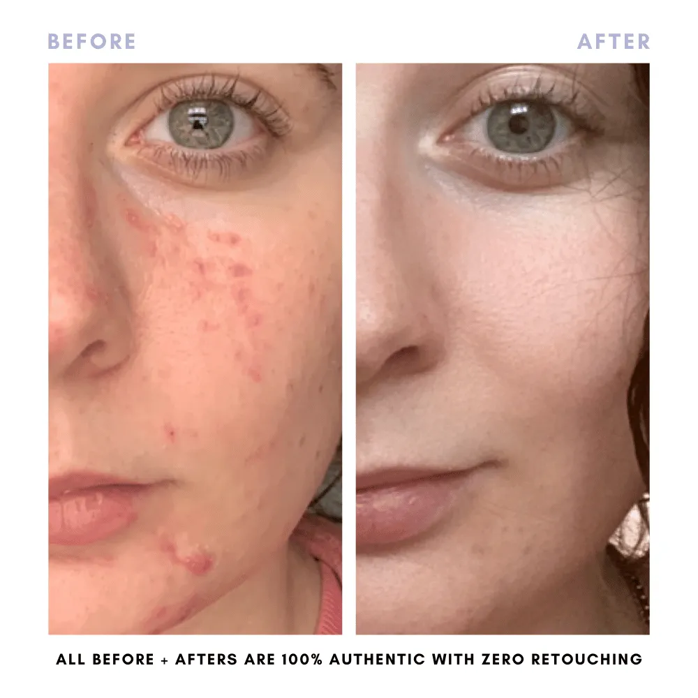 BUNDLE & SAVE! The Core Skincare Set