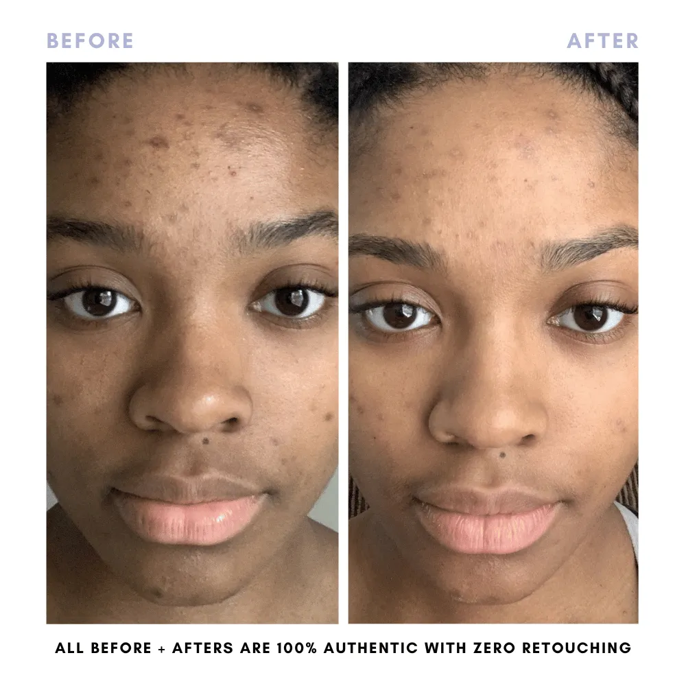 BUNDLE & SAVE! The Core Skincare Set